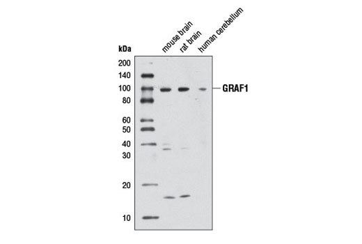 Western Blotting Image 1: GRAF1 Antibody