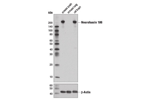 Western Blotting Image 1: Neurofascin 186 (D6G6O) Rabbit mAb (BSA and Azide Free)