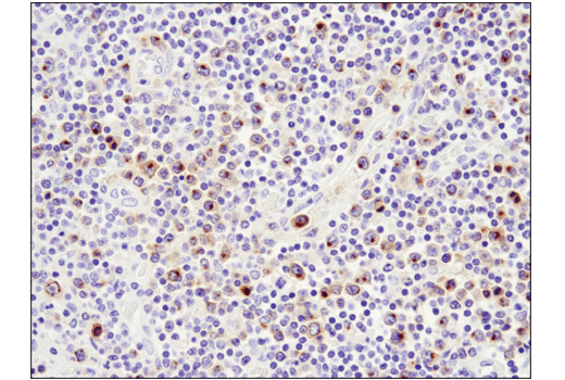 Immunohistochemistry Image 8: TNFRSF17/BCMA (E6D7B) Rabbit mAb
