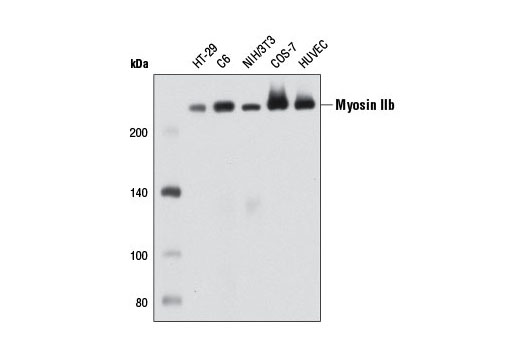 Western Blotting Image 1: Myosin IIb (D8H8) XP® Rabbit mAb