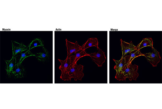 Immunofluorescence Image 1: Myosin IIb (D8H8) XP® Rabbit mAb