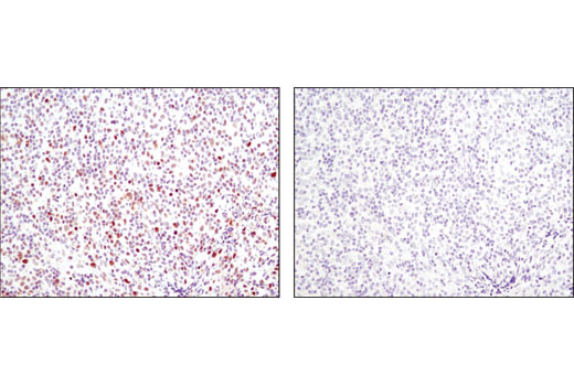 Immunohistochemistry Image 2: Phospho-Stat1 (Ser727) (D3B7) Rabbit mAb