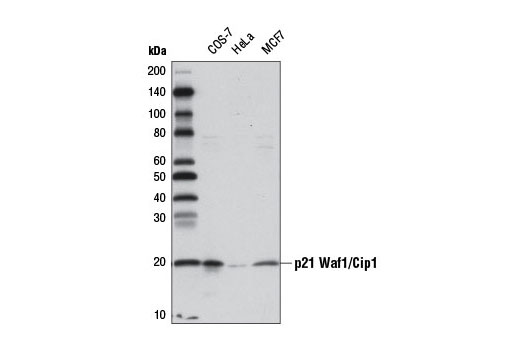 Western Blotting Image 1: p21 Waf1/Cip1 (12D1) Rabbit mAb (Biotinylated)