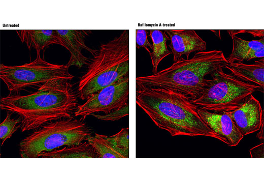 Immunofluorescence Image 1: SQSTM1/p62 (D1D9E3) Rabbit mAb (Alexa Fluor® 488 Conjugate)