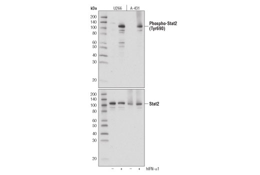 Image 16: IFN (Type I/III) Signaling Pathway Antibody Sampler Kit
