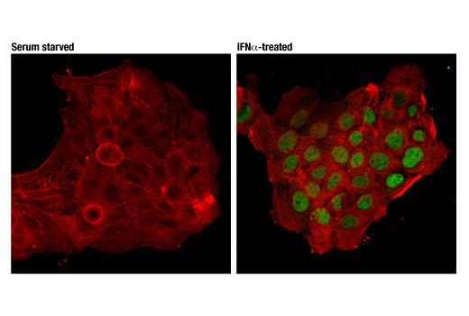 Immunofluorescence Image 1: Phospho-Stat2 (Tyr690) (D3P2P) Rabbit mAb (BSA and Azide Free)