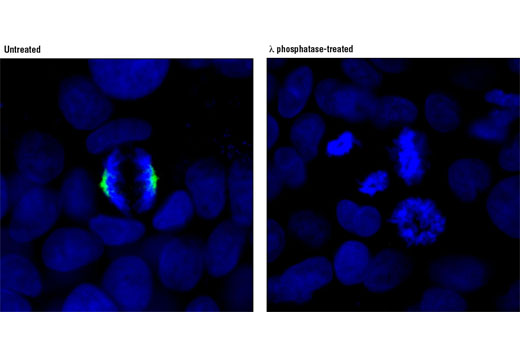 Immunofluorescence Image 1: Phospho-TACC3 (Ser558) (D8H10) XP® Rabbit mAb