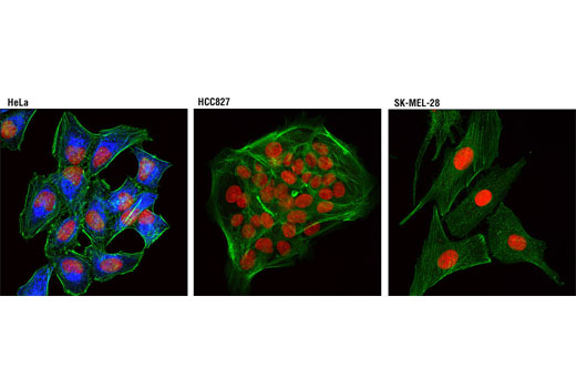 Immunofluorescence Image 1: Keratin 17 (D73C7) Rabbit mAb (Alexa Fluor® 647 Conjugate)
