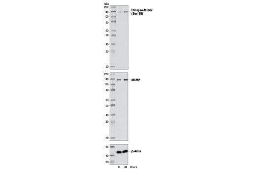 Western Blotting Image 1: Phospho-MCM2 (Ser139) Antibody