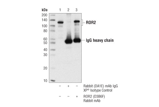 Immunoprecipitation Image 1: ROR2 (D3B6F) Rabbit mAb