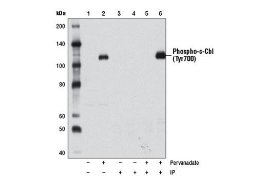 Immunoprecipitation Image 1: Phospho-c-Cbl (Tyr700) (D16D7) Rabbit mAb