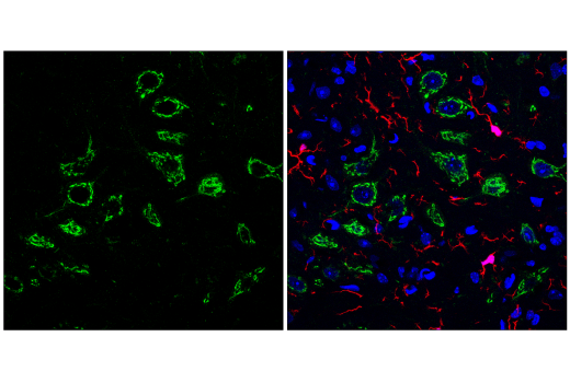 Immunofluorescence Image 2: Osteopontin/SPP1 (E9Z1D) Rabbit mAb