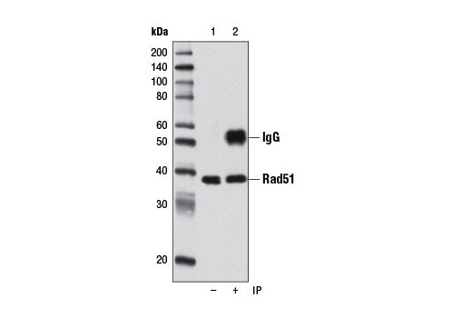 Immunoprecipitation Image 1: Rad51 (D4B10) Rabbit mAb