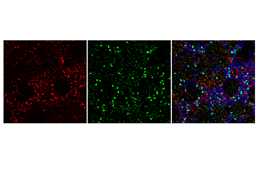 Immunofluorescence Image 1: Anti-mouse IgG (H+L), F(ab')2 Fragment (Alexa Fluor® 594 Conjugate)