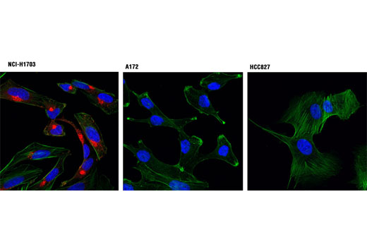 Immunofluorescence Image 1: PDGF Receptor α (D13C6) XP® Rabbit mAb (Alexa Fluor® 555 Conjugate)