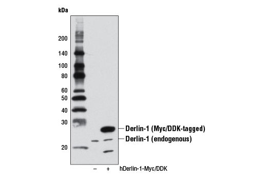 Western Blotting Image 1: Derlin-1 Antibody