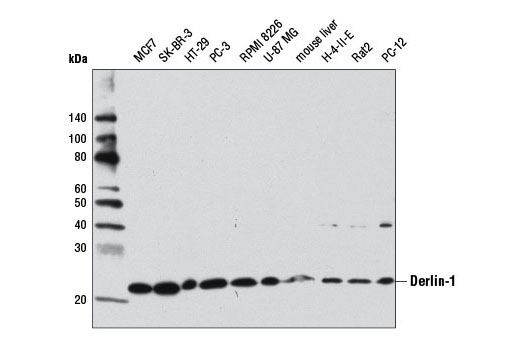 Western Blotting Image 2: Derlin-1 Antibody