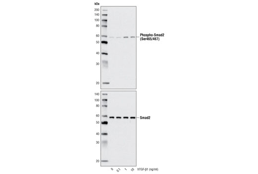  Image 3: Human Transforming Growth Factor β1 (hTGF-β1)