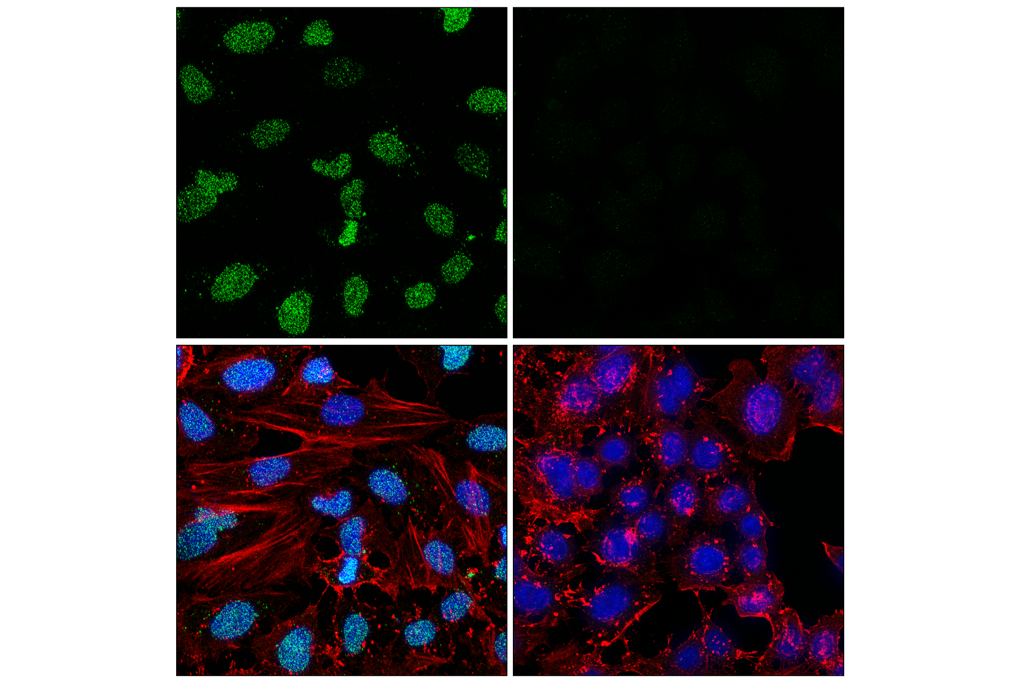Immunofluorescence Image 2: Poly/Mono-ADP Ribose (D9P7Z) Rabbit mAb