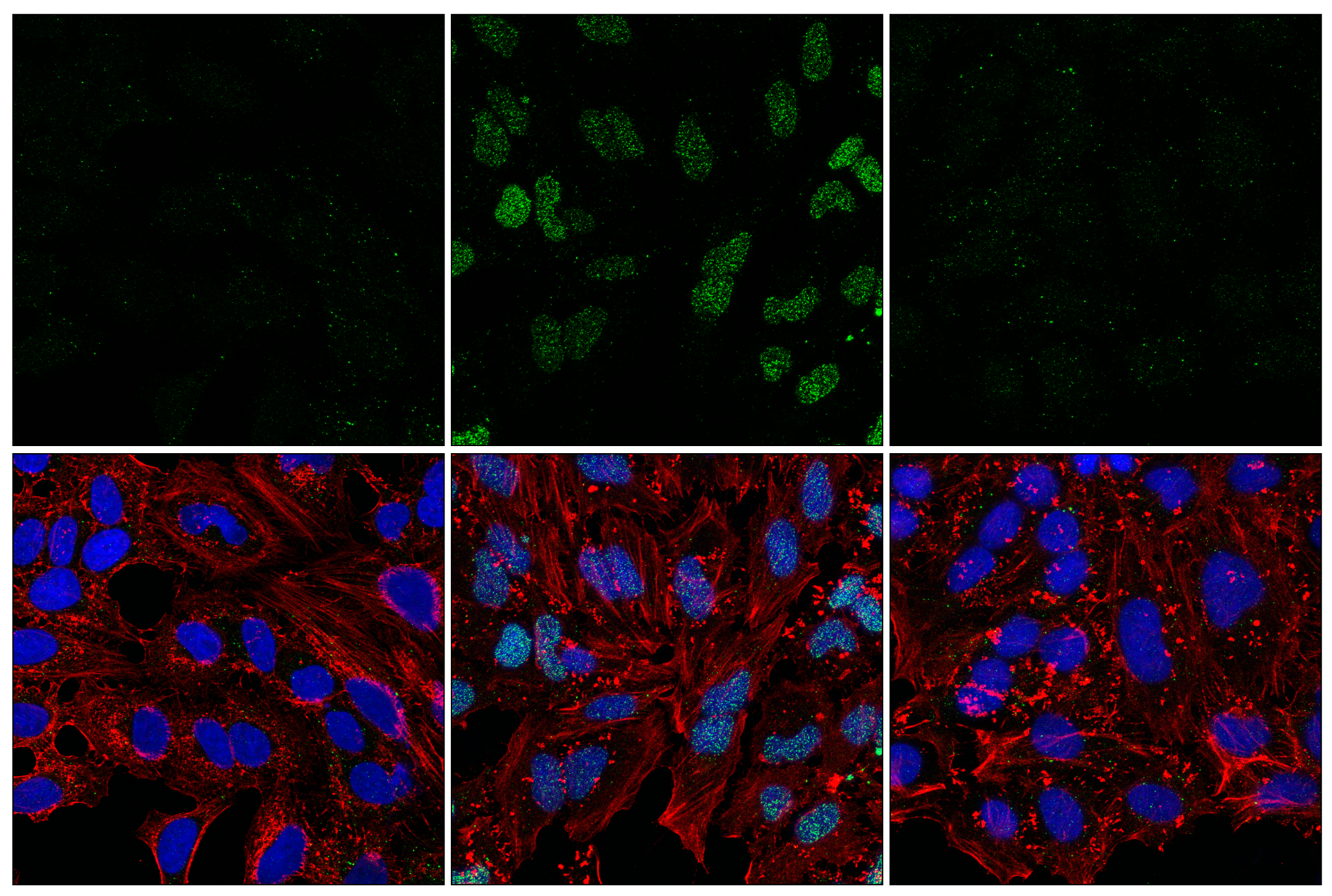 Immunofluorescence Image 1: Poly/Mono-ADP Ribose (D9P7Z) Rabbit mAb