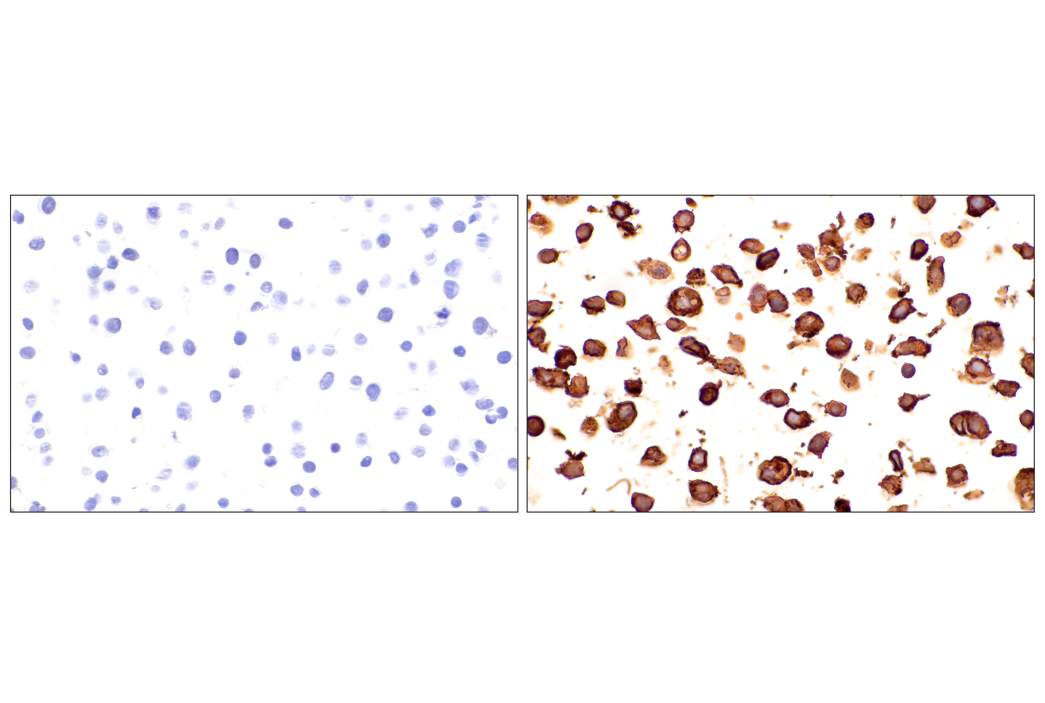 Immunohistochemistry Image 16: EMCN (E3Z4D) Rabbit mAb (BSA and Azide Free)