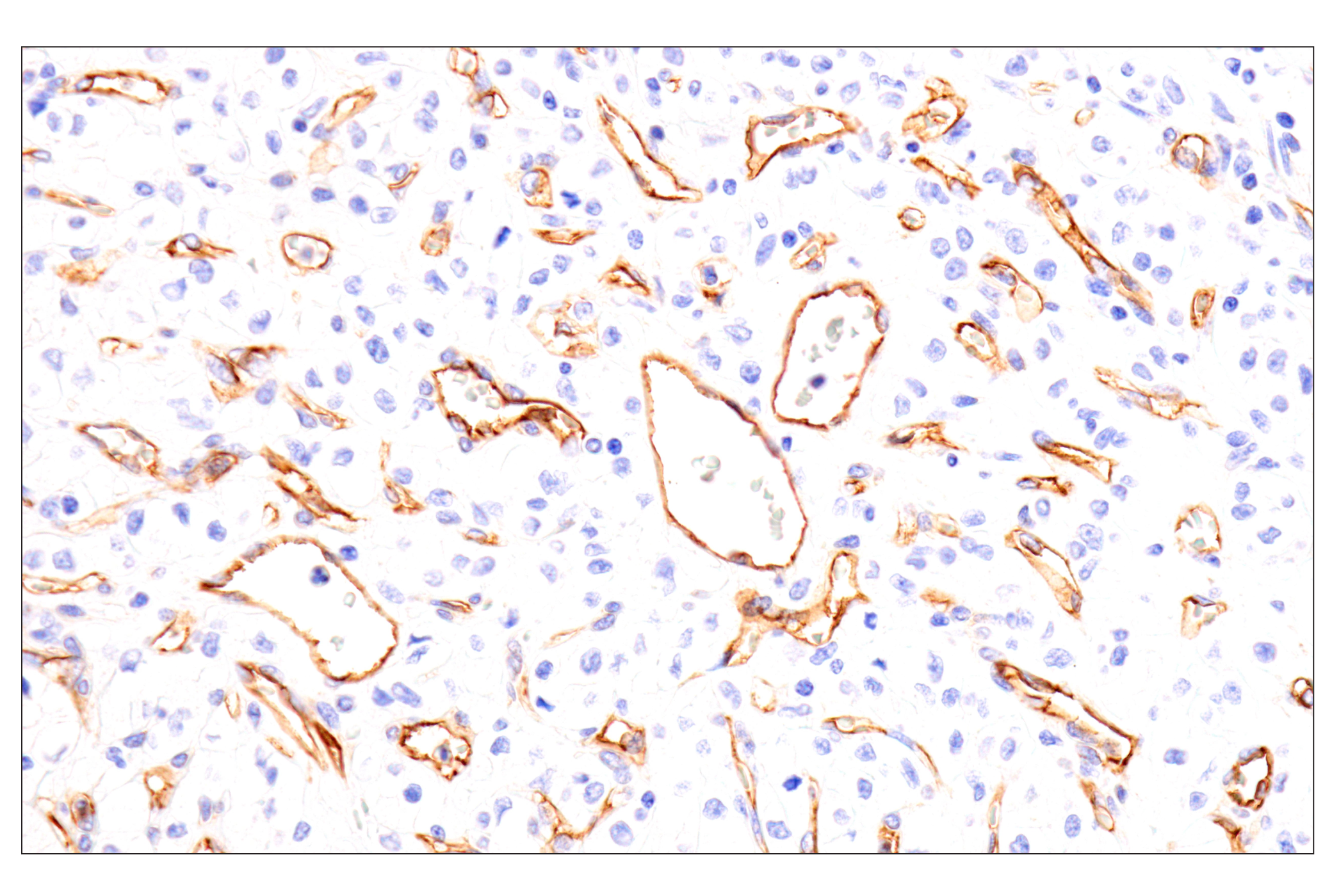 Immunohistochemistry Image 1: EMCN (E3Z4D) Rabbit mAb (BSA and Azide Free)