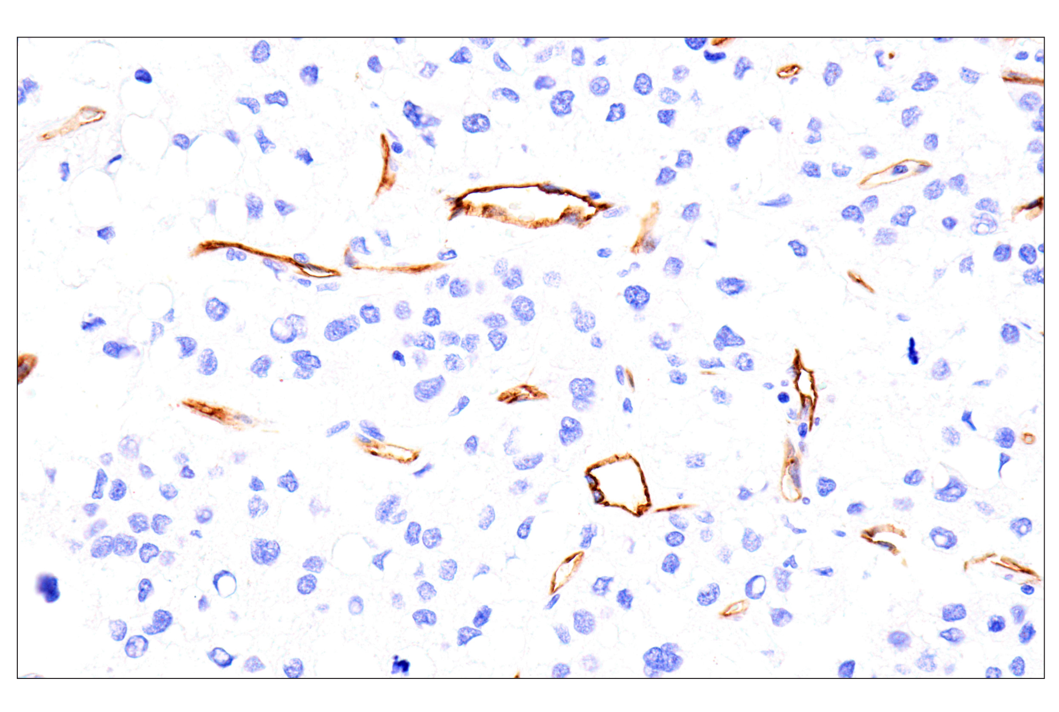 Immunohistochemistry Image 6: EMCN (E3Z4D) Rabbit mAb (BSA and Azide Free)