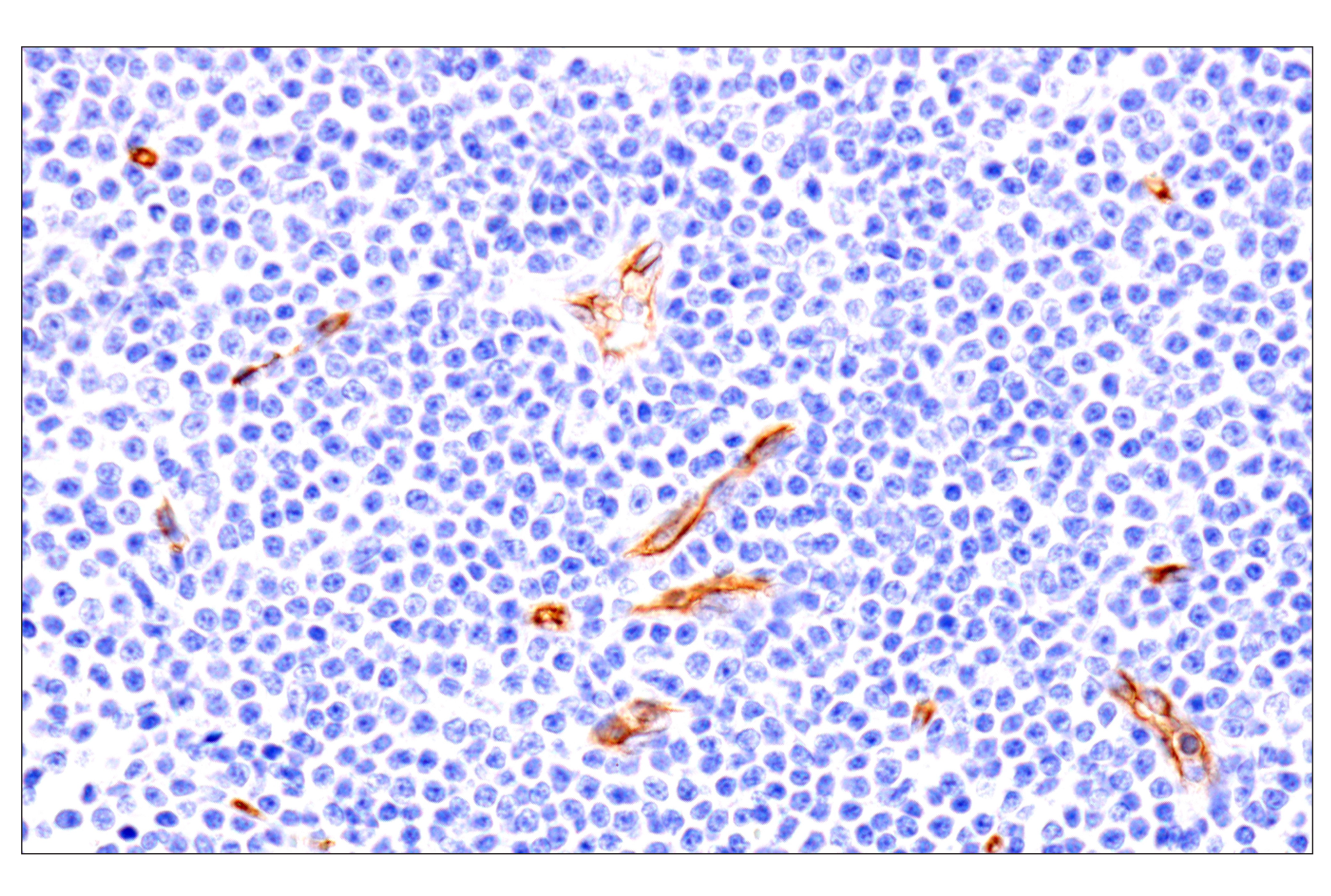 Immunohistochemistry Image 5: EMCN (E3Z4D) Rabbit mAb (BSA and Azide Free)