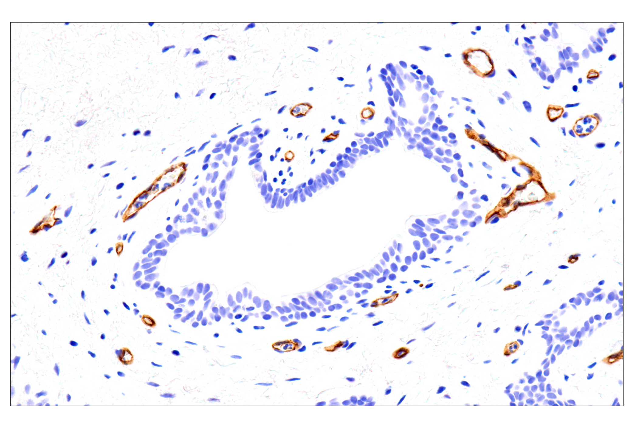 Immunohistochemistry Image 3: EMCN (E3Z4D) Rabbit mAb (BSA and Azide Free)