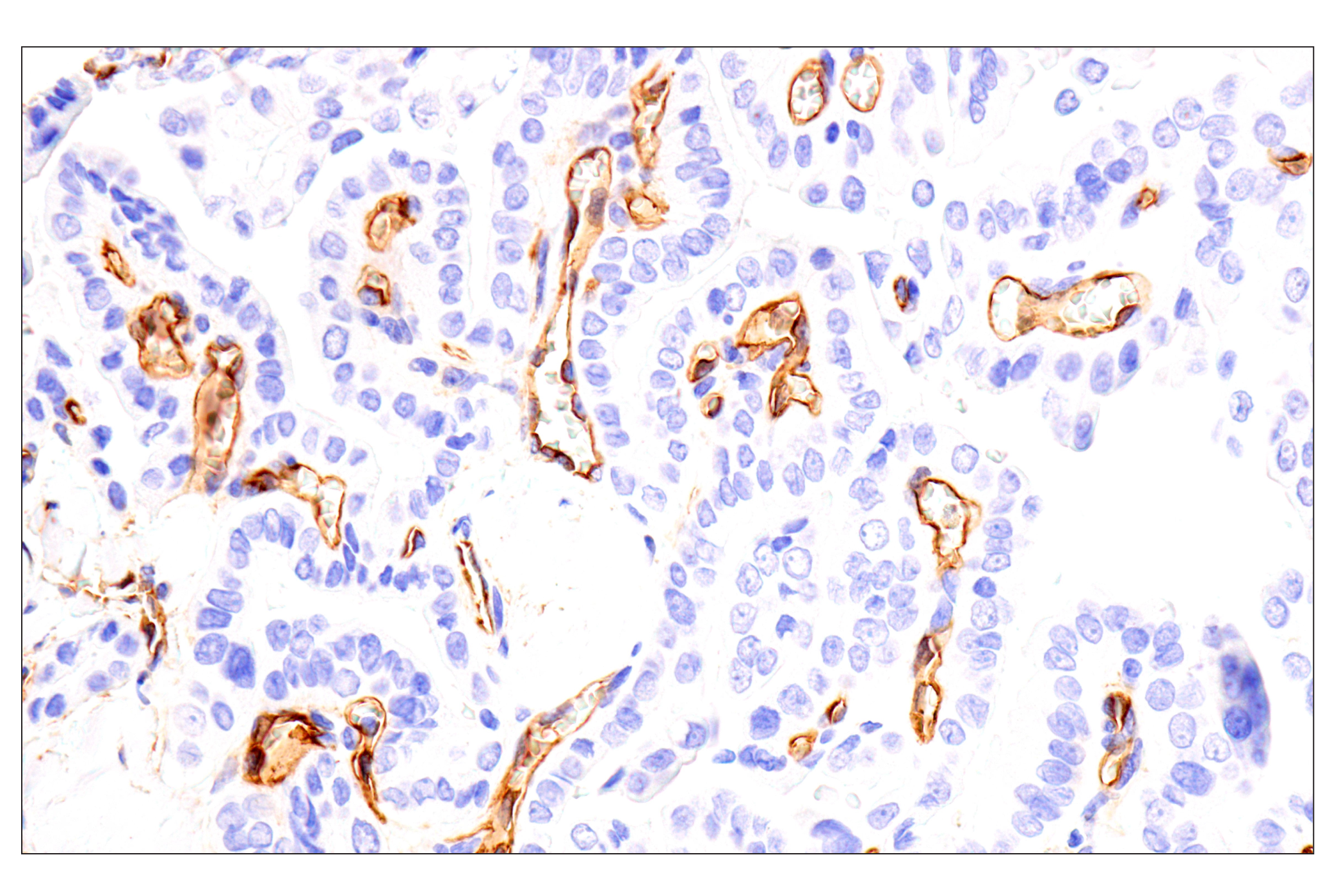 Immunohistochemistry Image 2: EMCN (E3Z4D) Rabbit mAb (BSA and Azide Free)