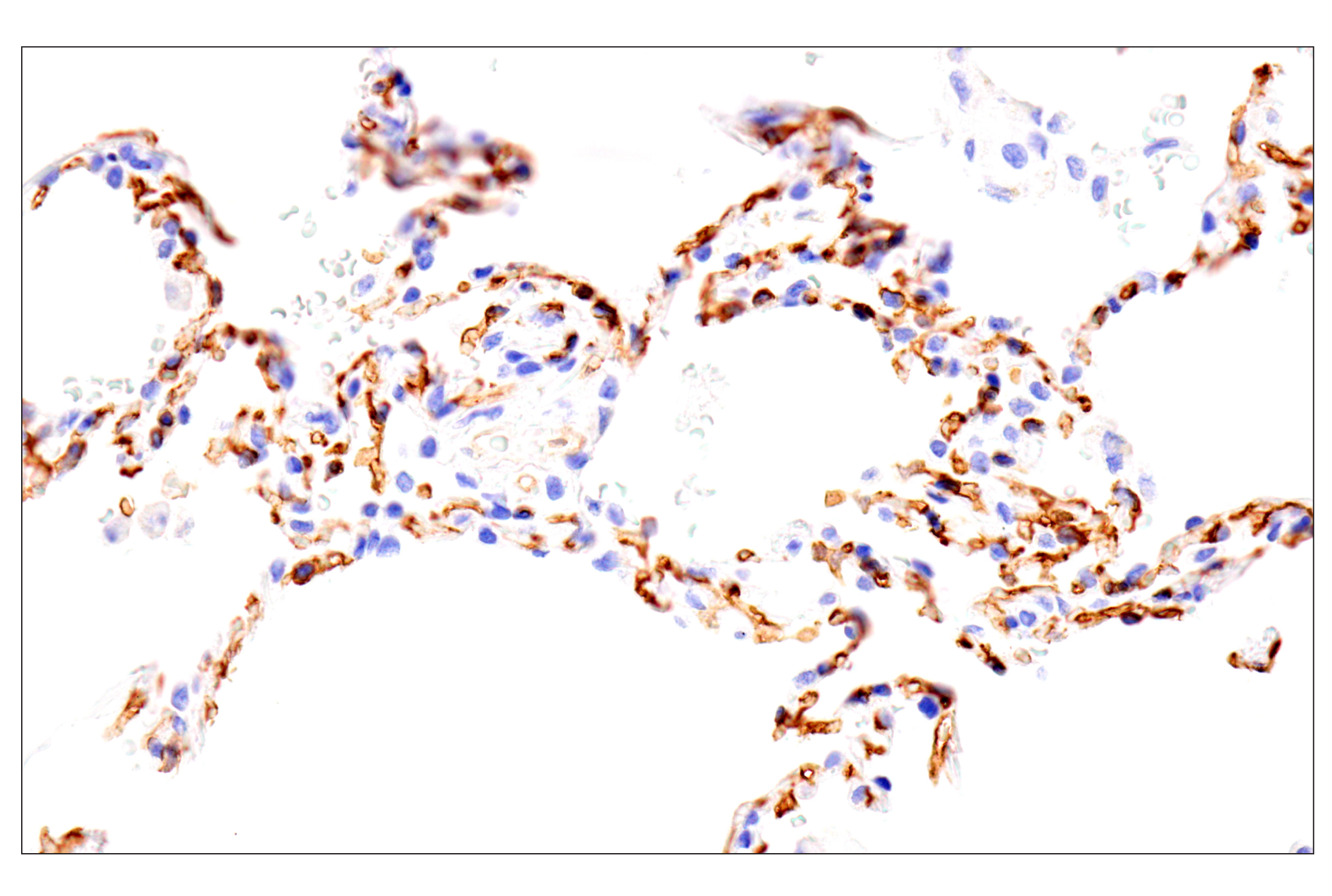 Immunohistochemistry Image 10: EMCN (E3Z4D) Rabbit mAb (BSA and Azide Free)