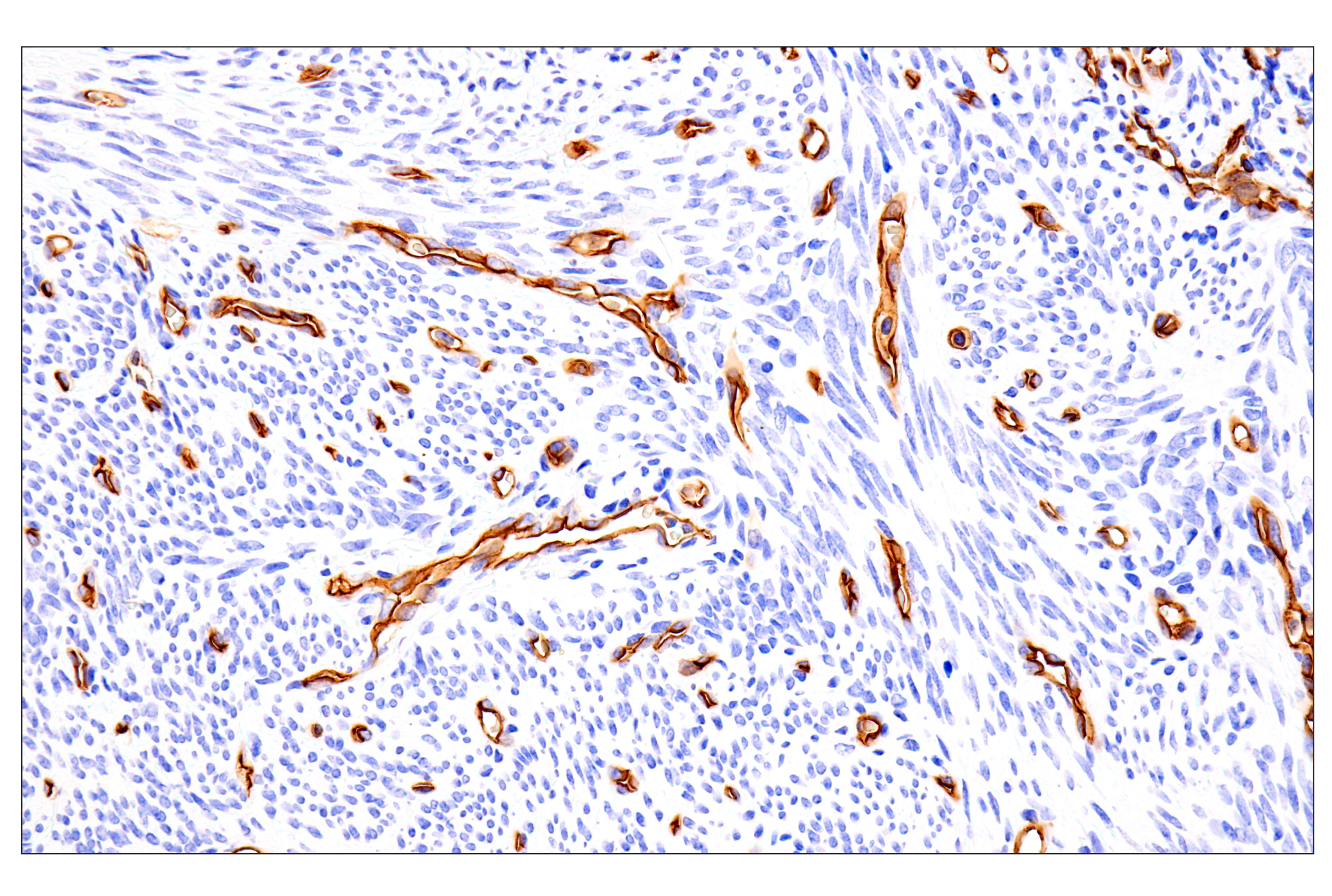 Immunohistochemistry Image 9: EMCN (E3Z4D) Rabbit mAb (BSA and Azide Free)