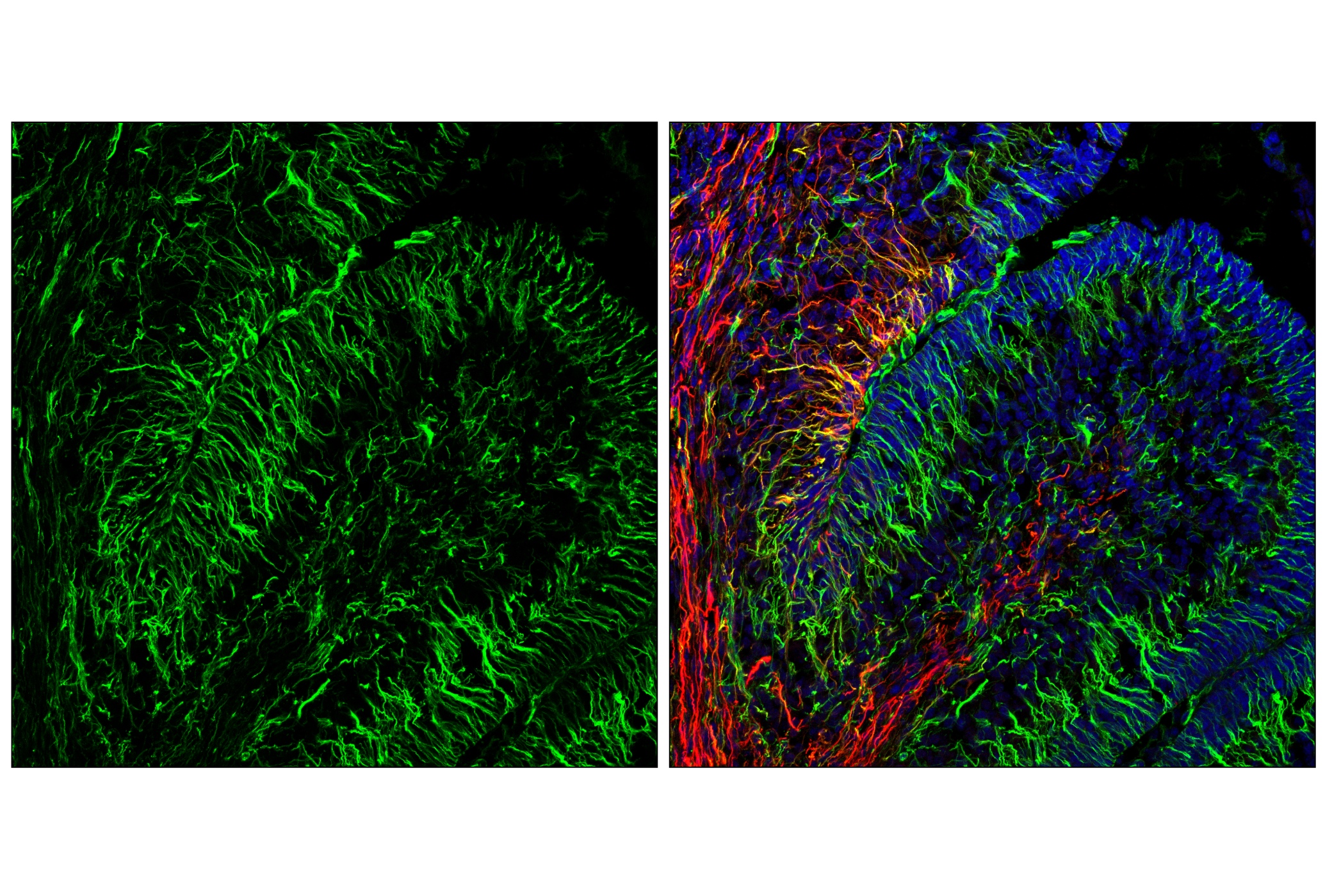 Immunofluorescence Image 1: Nestin (E5C7I) Rabbit mAb