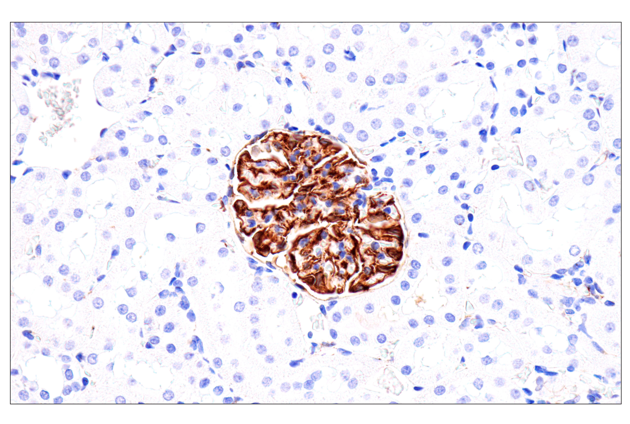 Immunohistochemistry Image 11: Nestin (E5C7I) Rabbit mAb