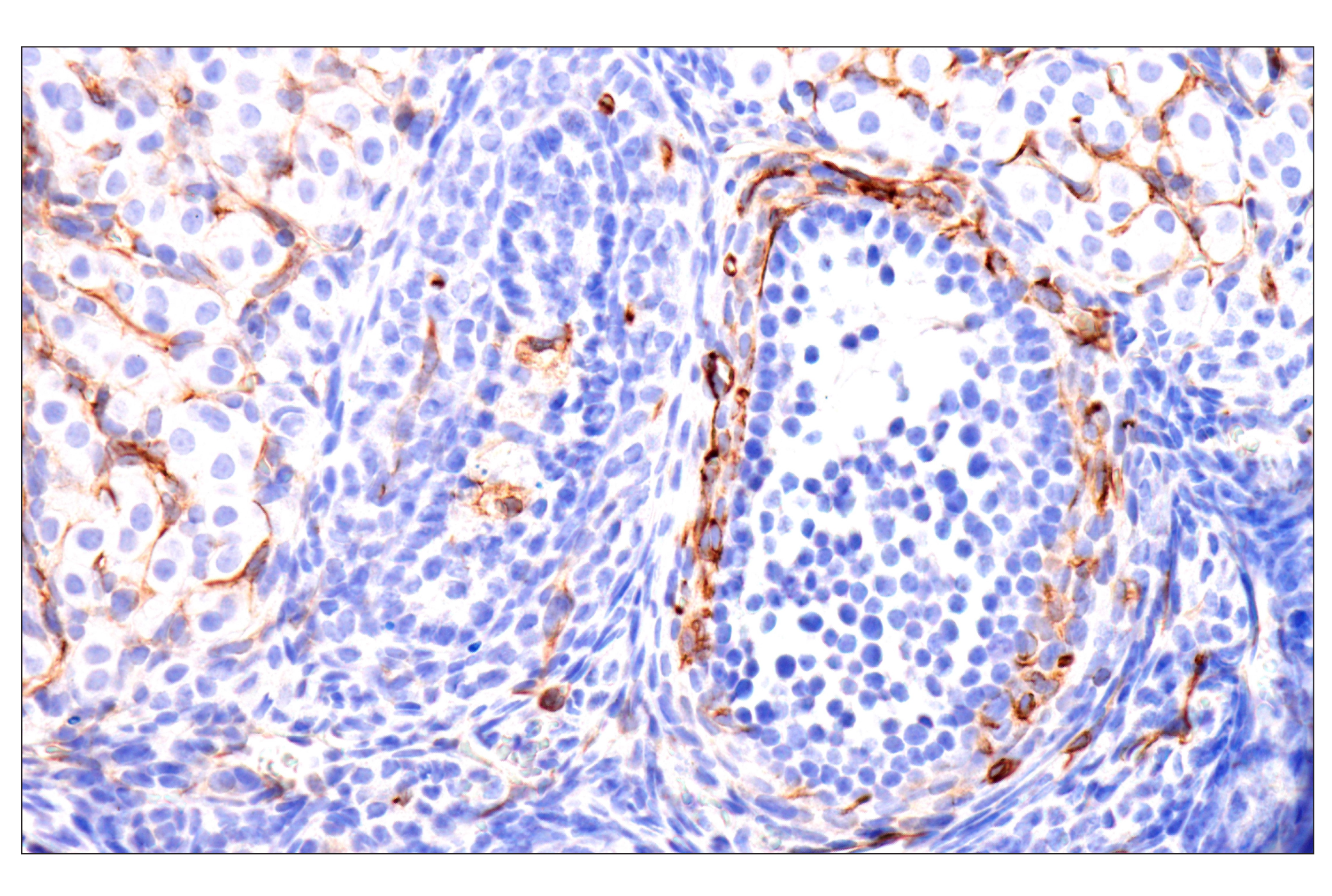 Immunohistochemistry Image 6: Nestin (E5C7I) Rabbit mAb