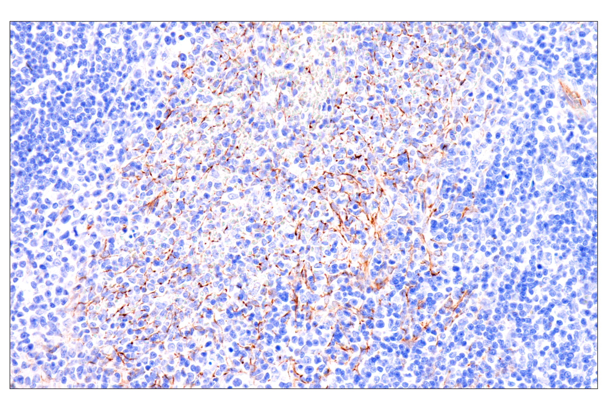Immunohistochemistry Image 9: Nestin (E5C7I) Rabbit mAb
