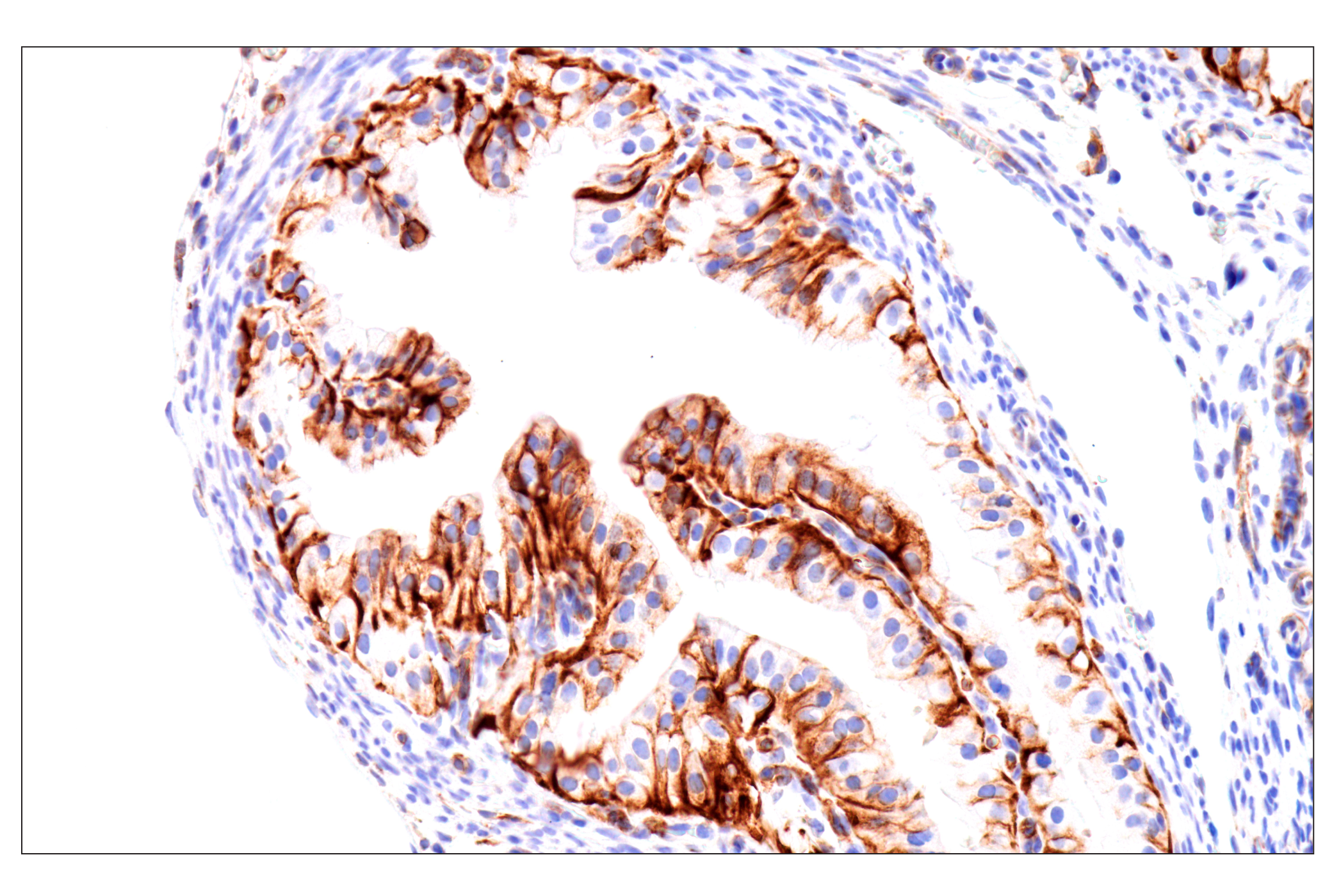 Immunohistochemistry Image 2: Nestin (E5C7I) Rabbit mAb