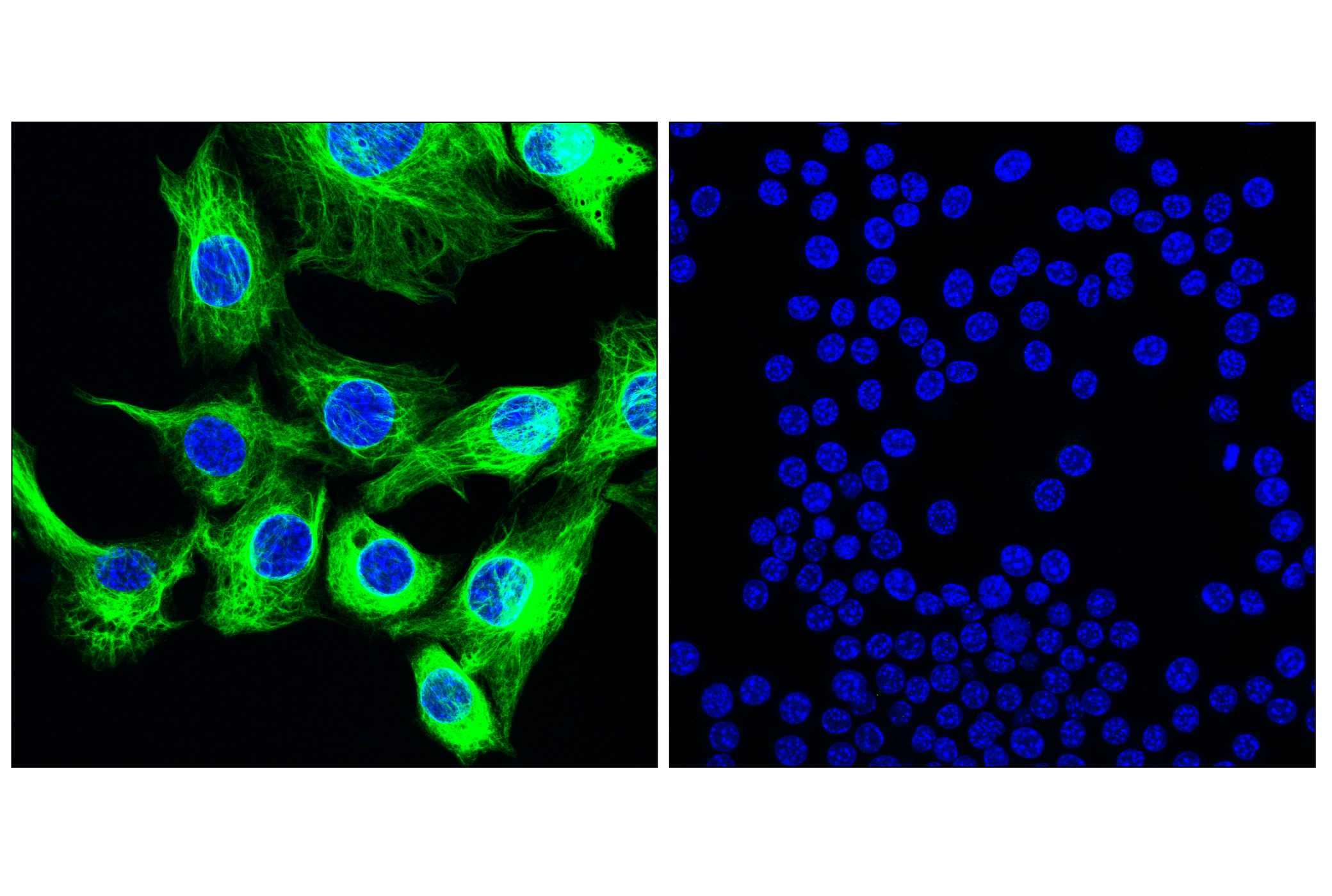 Immunofluorescence Image 3: Nestin (E5C7I) Rabbit mAb
