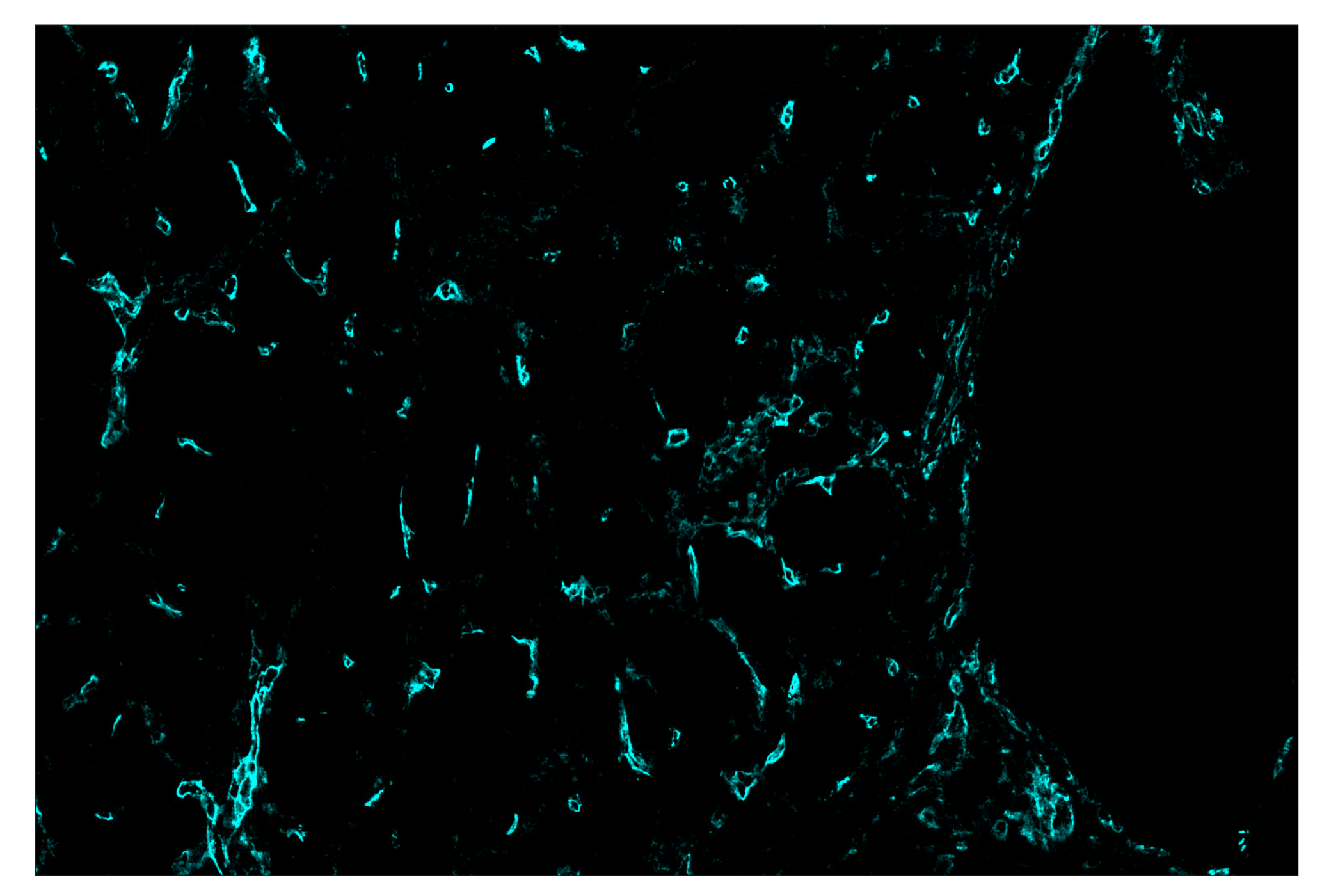 Immunohistochemistry Image 5: CD141/Thrombomodulin (E7Y9P) & CO-0088-647 SignalStar™ Oligo-Antibody Pair