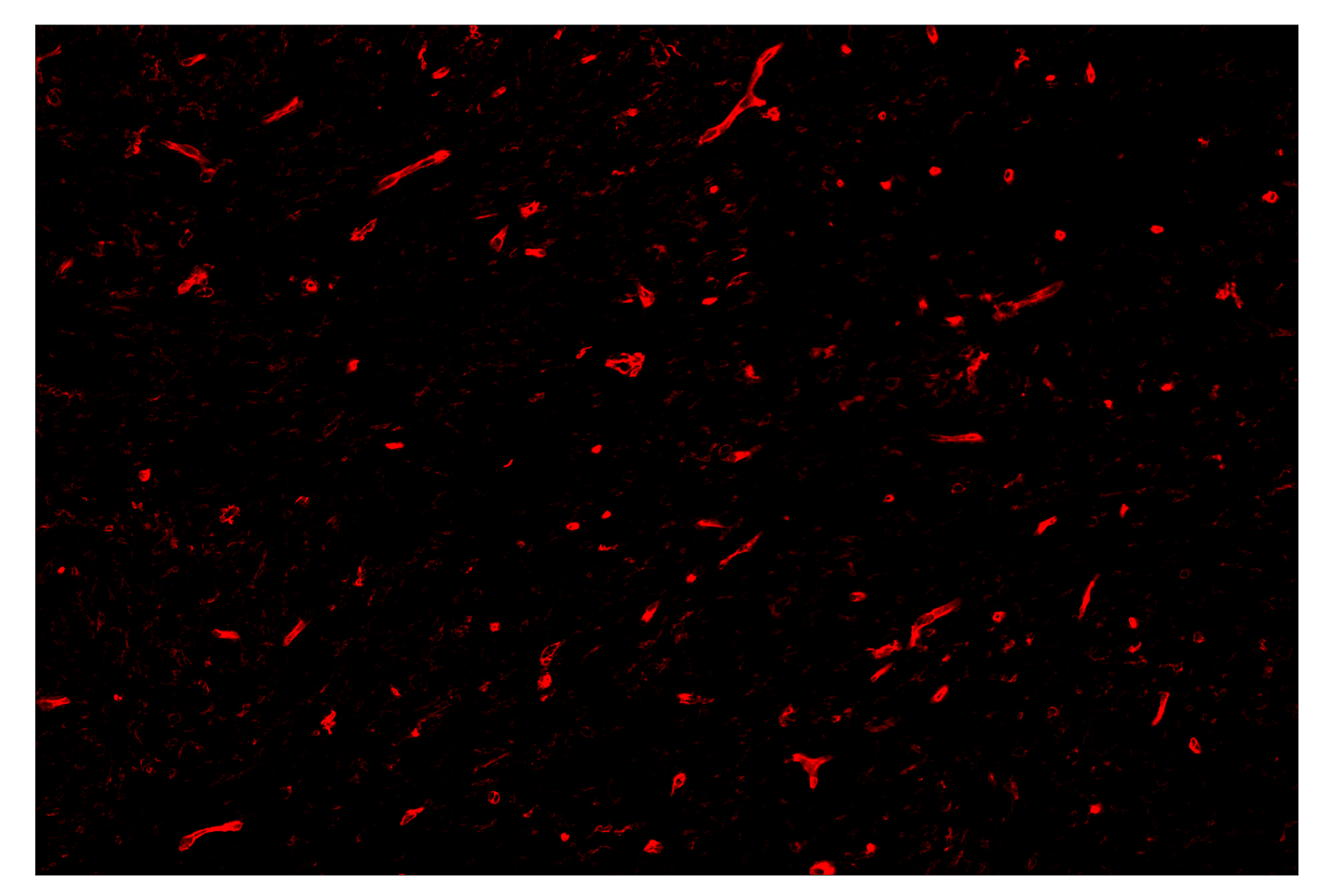 Immunohistochemistry Image 4: CD141/Thrombomodulin (E7Y9P) & CO-0088-594 SignalStar™ Oligo-Antibody Pair