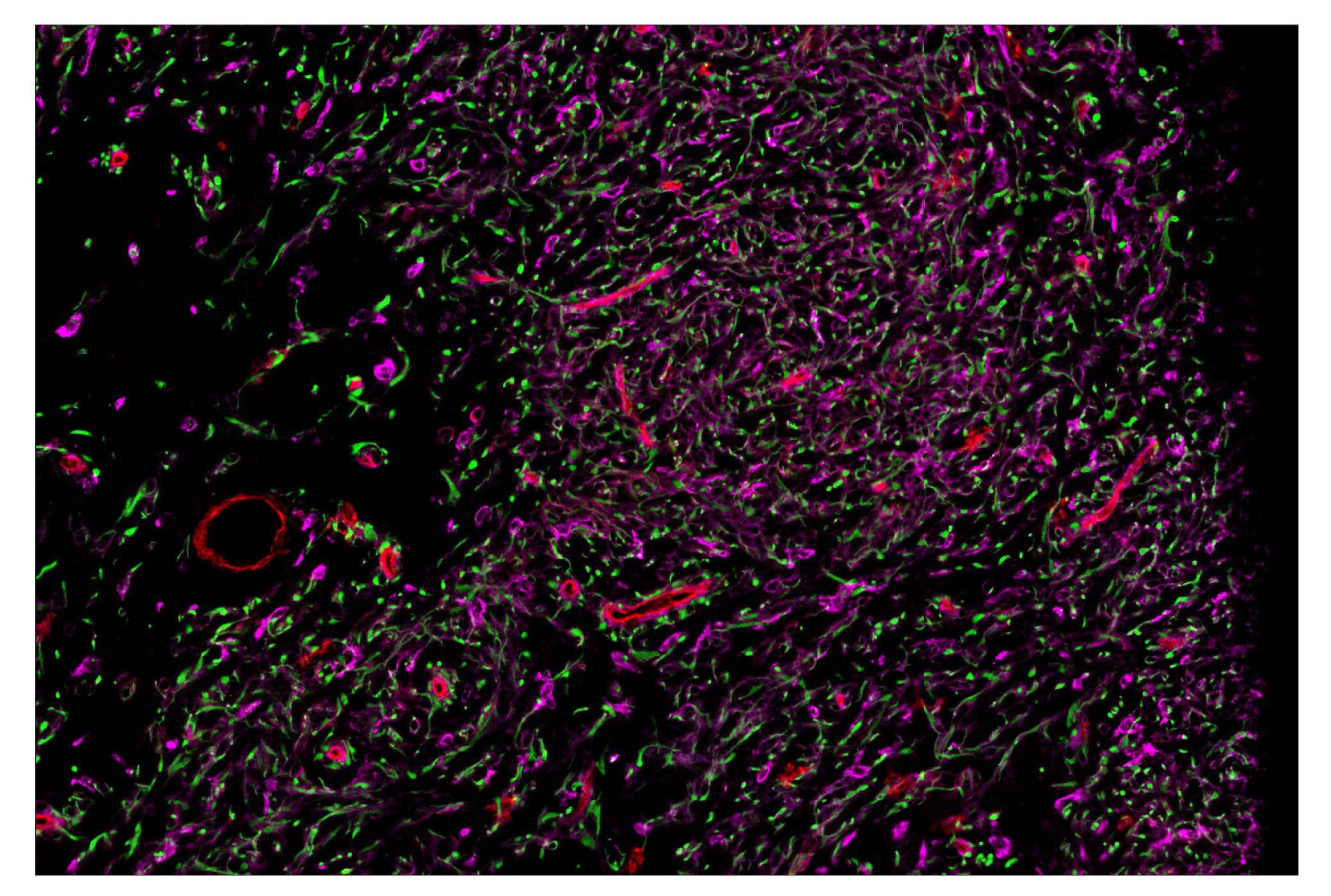 Immunohistochemistry Image 1: CD141/Thrombomodulin (E7Y9P) & CO-0088-594 SignalStar™ Oligo-Antibody Pair