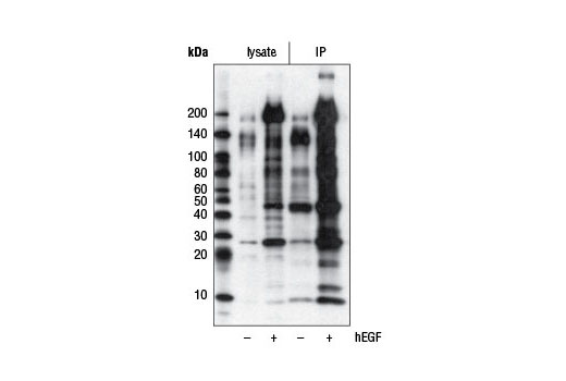Immunoprecipitation Image 1: Phospho-Tyrosine (P-Tyr-1000) MultiMab®  Rabbit mAb mix