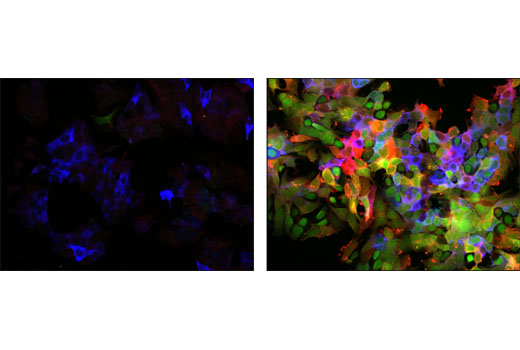 Immunofluorescence Image 1: PathScan® Signaling Nodes Multiplex IF Kit