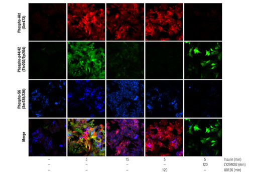 Immunofluorescence Image 2: PathScan® Signaling Nodes Multiplex IF Kit