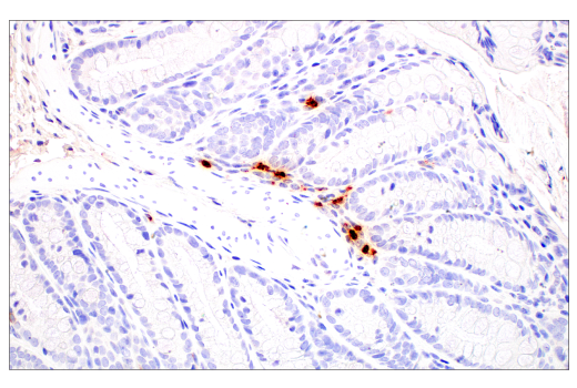Immunohistochemistry Image 4: Neutrophil Elastase (E8U3X) Rabbit mAb (BSA and Azide Free)
