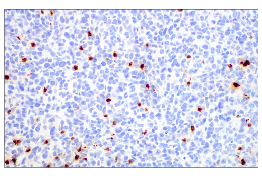 Immunohistochemistry Image 1: Neutrophil Elastase (E8U3X) Rabbit mAb (BSA and Azide Free)