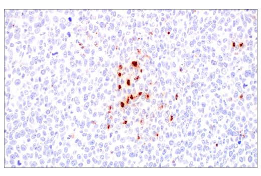 Immunohistochemistry Image 7: Neutrophil Elastase (E8U3X) Rabbit mAb (BSA and Azide Free)