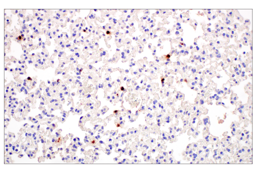 Immunohistochemistry Image 8: Neutrophil Elastase (E8U3X) Rabbit mAb (BSA and Azide Free)