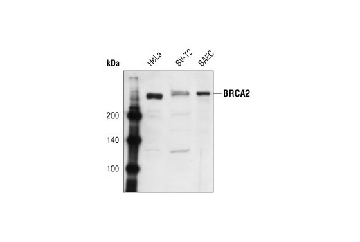 Western Blotting Image 1: BRCA2 Antibody