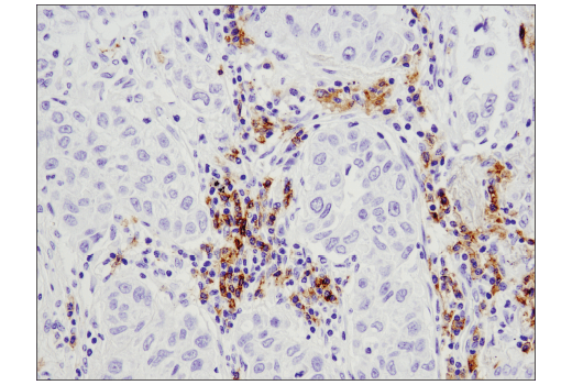 Immunohistochemistry Image 3: CD19 (Intracellular Domain) (D4V4B) XP® Rabbit mAb